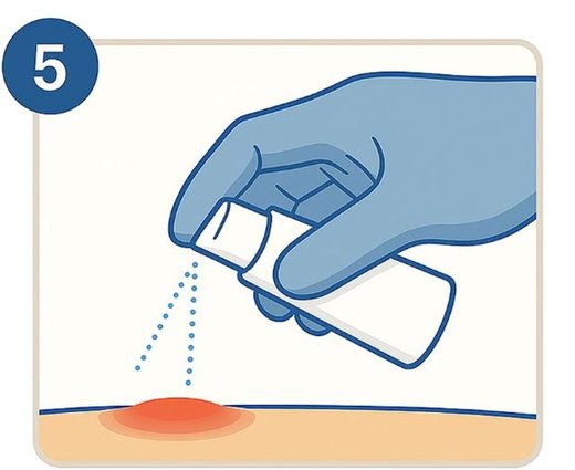 Post-treatment care